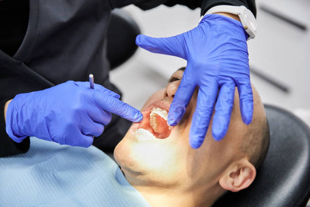 Best Emergency Broken Tooth Repair in Malmstrom Af, MT