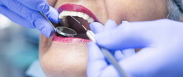Best Emergency Wisdom Teeth Removal in Malmstrom Af, MT
